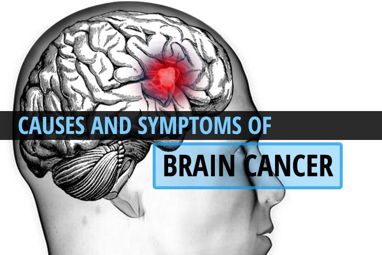 6 Crucial Facts You Need To Know About Brain Cancer